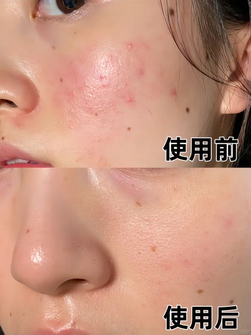 十大适合追求年轻肌肤的人九游会j9ag抗皱面霜(图6)